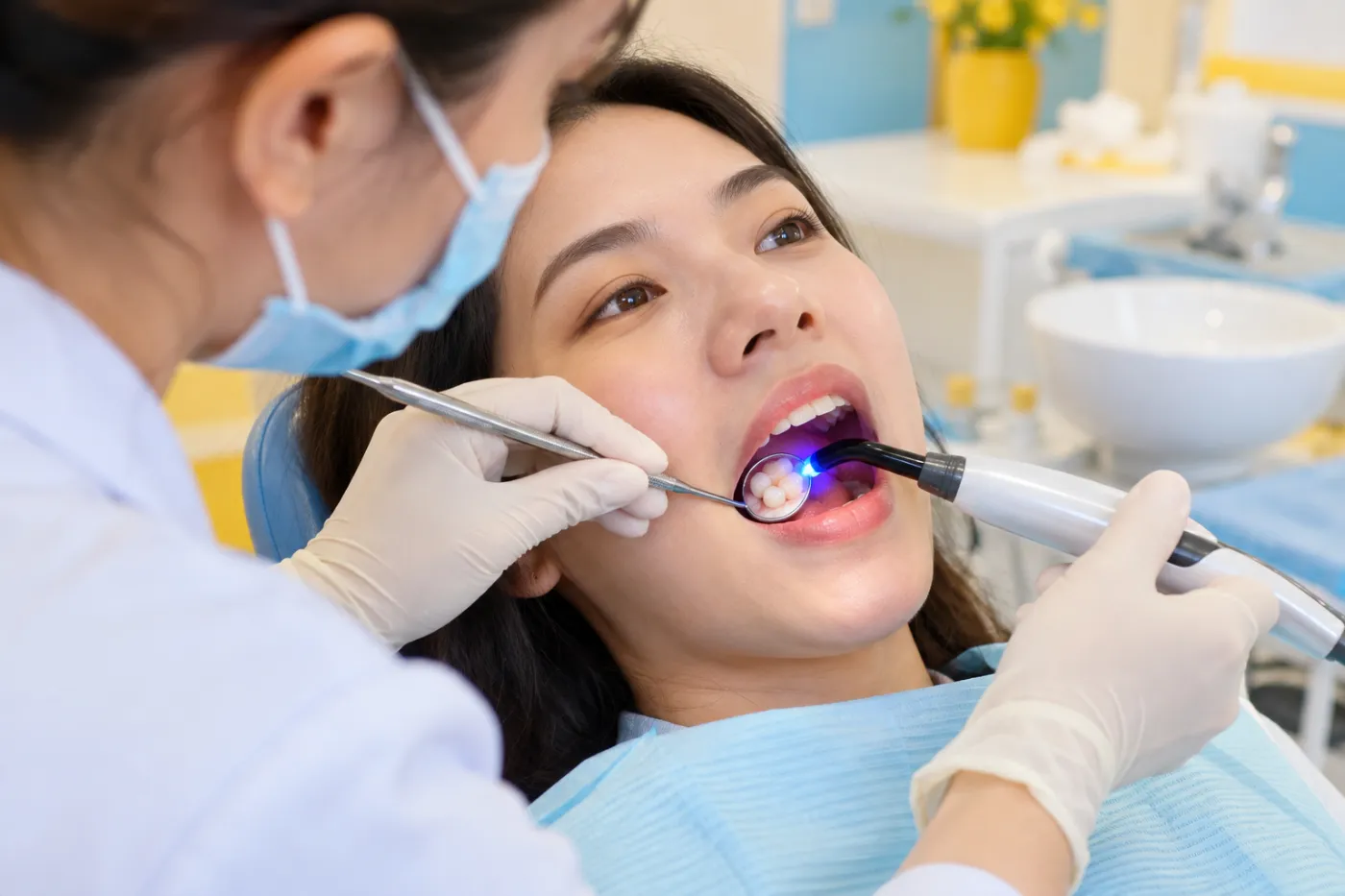 Trám răng thẩm mỹ bằng composite